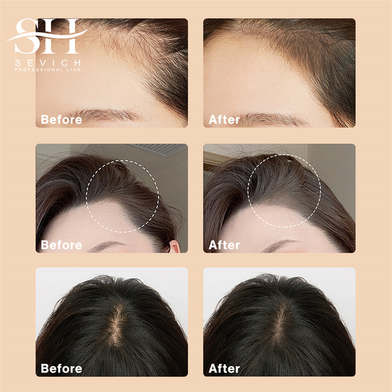 SEVICH 12g Hairline Powder Wit – Rooting Hormone Powder recenzja i cena